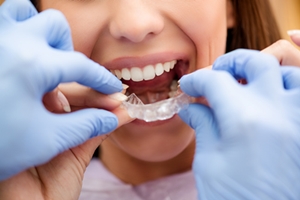 (P) NOU! Servicii de Ortodontie la Clinica Stomatologica DR. GRIGORIU® Bacau